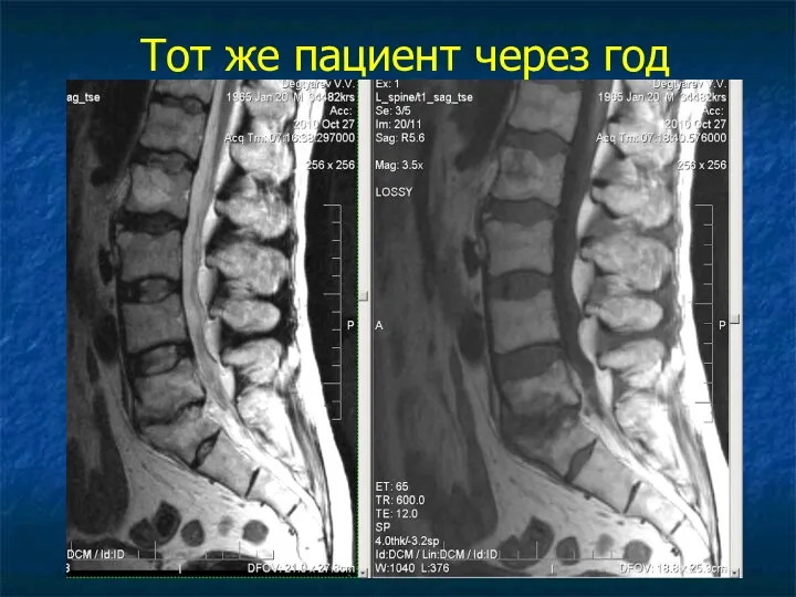 Тот же пациент через год