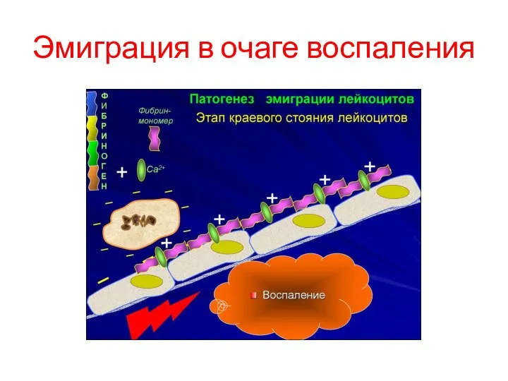 Эмиграция в очаге воспаления