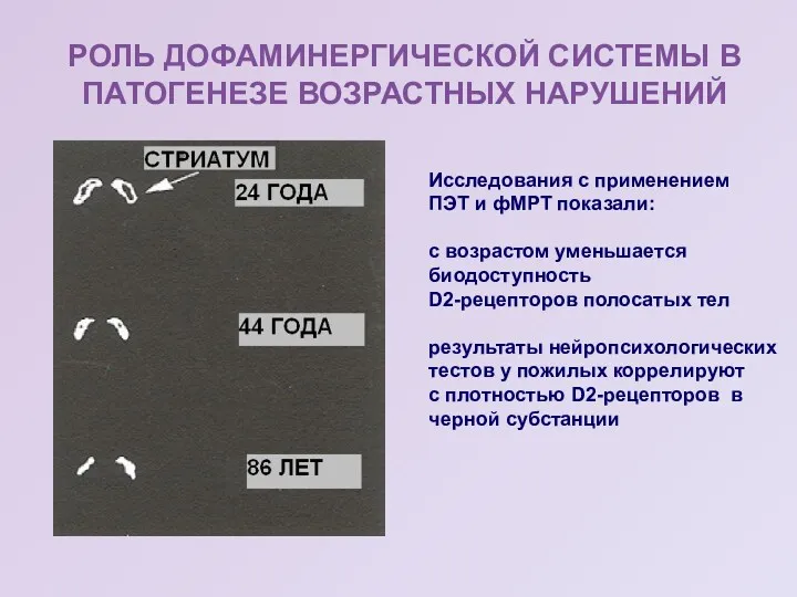 РОЛЬ ДОФАМИНЕРГИЧЕСКОЙ СИСТЕМЫ В ПАТОГЕНЕЗЕ ВОЗРАСТНЫХ НАРУШЕНИЙ Исследования с применением