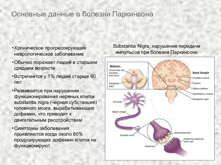 Основные данные о болезни Паркинсона Хроническое прогрессирующее неврологическое заболевание Обычно