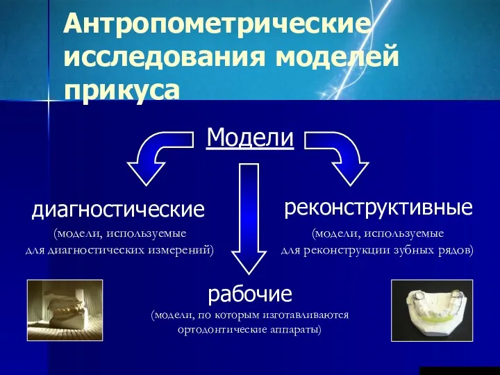 Антропометрические исследования моделей прикуса Модели диагностические реконструктивные рабочие (модели, по