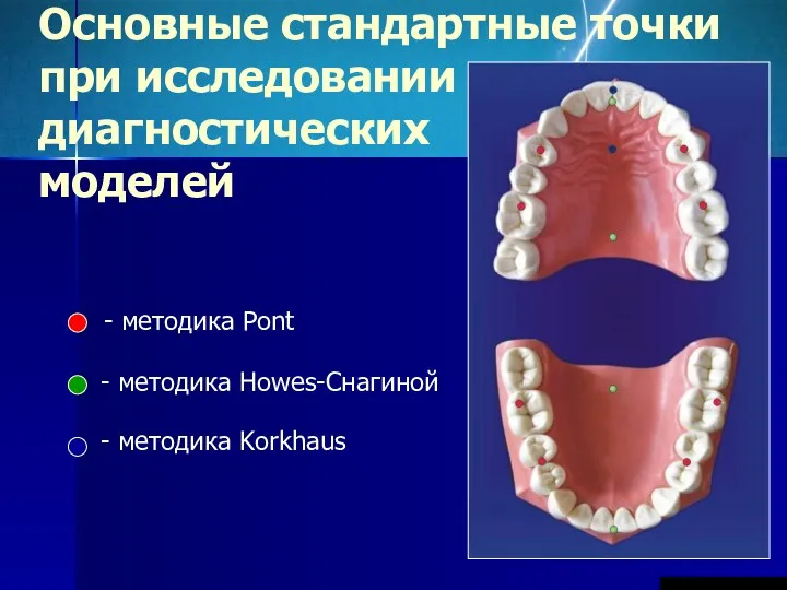 Основные стандартные точки при исследовании диагностических моделей - методика Pont - методика Howes-Снагиной - методика Korkhaus