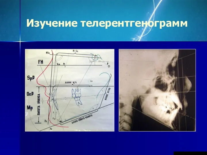 Изучение телерентгенограмм