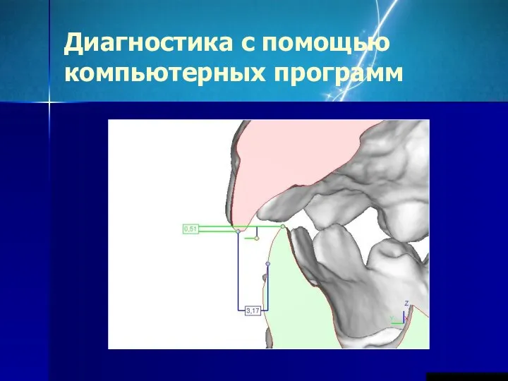 Диагностика с помощью компьютерных программ