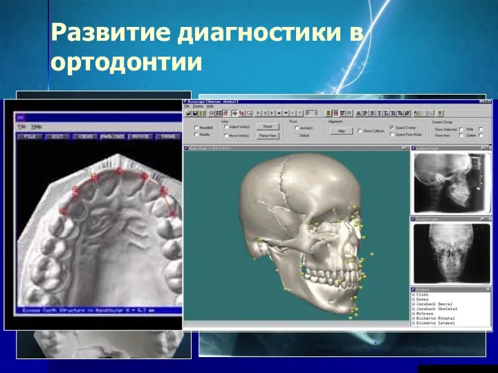 Развитие диагностики в ортодонтии