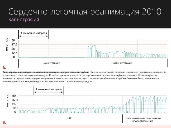 Сердечно-легочная реанимация 2010 Капнография