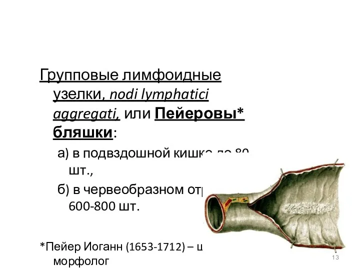 Групповые лимфоидные узелки, nodi lymphatici aggregati, или Пейеровы* бляшки: а) в подвздошной кишке