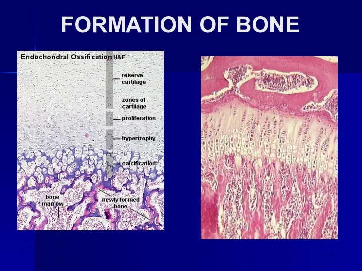 FORMATION OF BONE