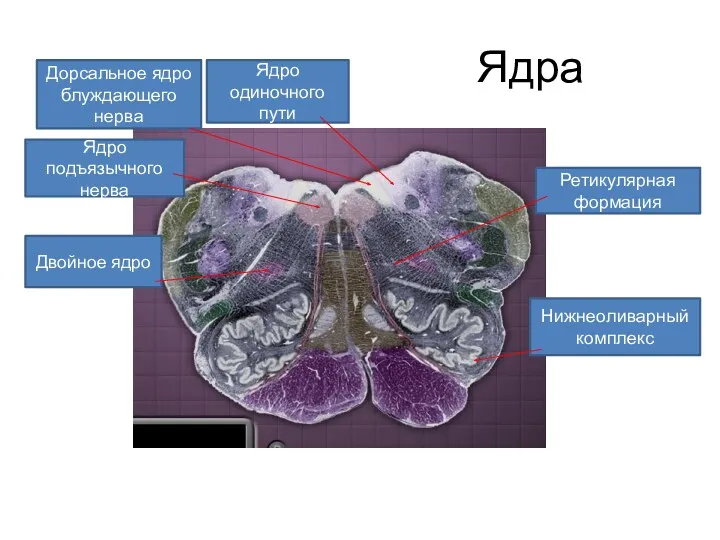 Ядра Ядро одиночного пути Дорсальное ядро блуждающего нерва Ядро подъязычного