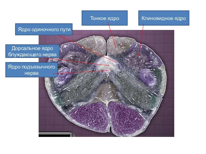 Клиновидное ядро Тонкое ядро Ядро одиночного пути Дорсальное ядро блуждающего нерва Ядро подъязычного нерва