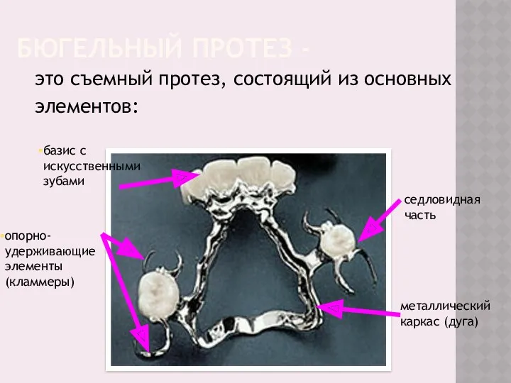 БЮГЕЛЬНЫЙ ПРОТЕЗ - это съемный протез, состоящий из основных элементов: