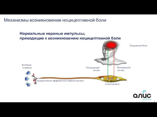 4 Механизмы возникновения ноцицептивной боли Нисходящий сигнал Восходящий сигнал Ноцицептивное