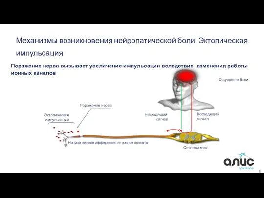 5 Ноцицептивное афферентное нервное волокно Спинной мозг Восходящий сигнал Нисходящий