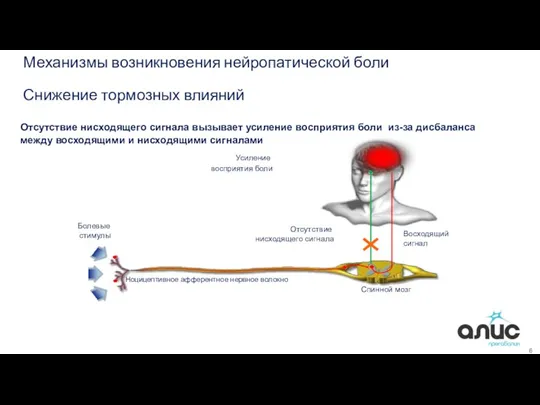 6 Механизмы возникновения нейропатической боли Снижение тормозных влияний Восходящий сигнал