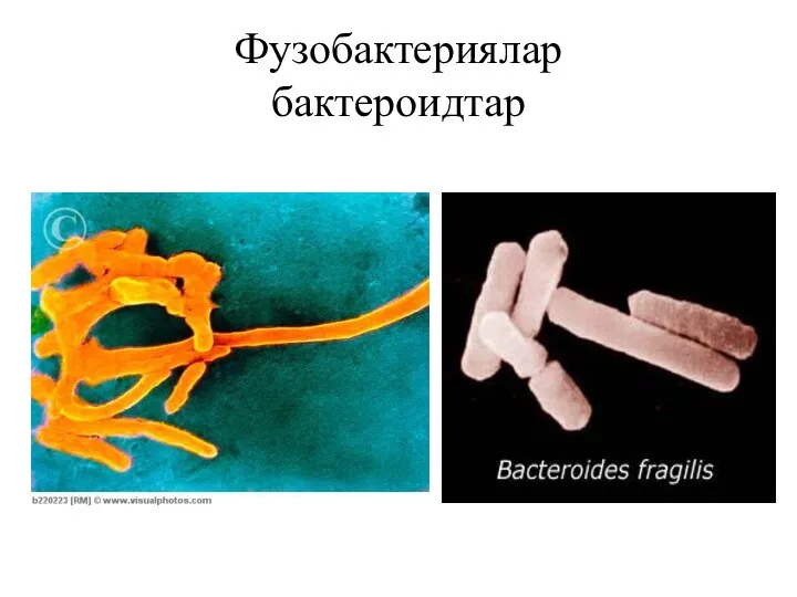 Фузобактериялар бактероидтар
