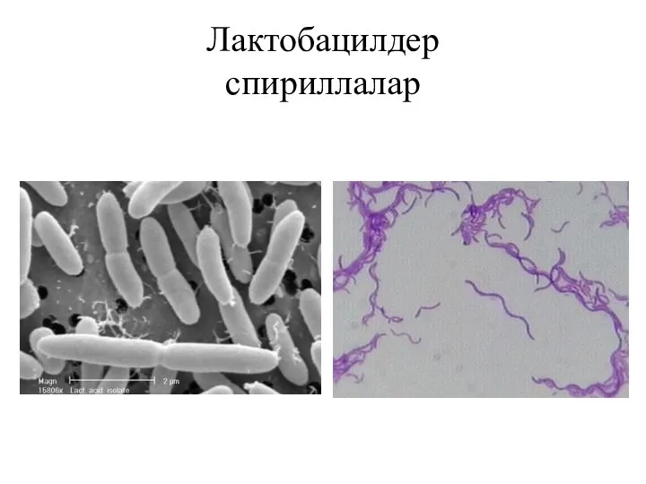 Лактобацилдер спириллалар