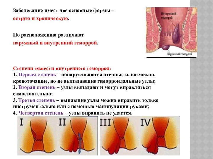 Заболевание имеет две основные формы – острую и хроническую. По