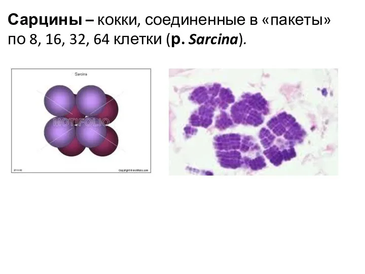 Сарцины – кокки, соединенные в «пакеты» по 8, 16, 32, 64 клетки (р. Sarcina).