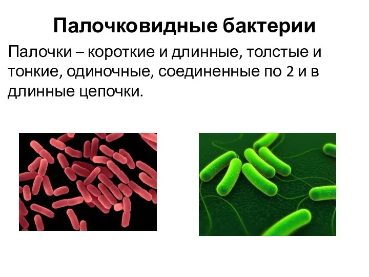 Палочковидные бактерии Палочки – короткие и длинные, толстые и тонкие,