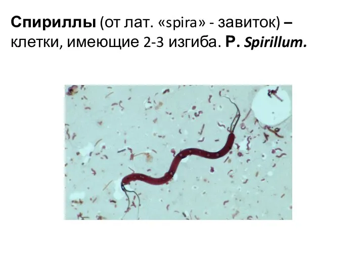 Спириллы (от лат. «spira» - завиток) – клетки, имеющие 2-3 изгиба. Р. Spirillum.