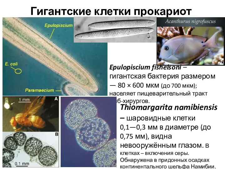 Гигантские клетки прокариот Epulopiscium fishelsoni – гигантская бактерия размером —