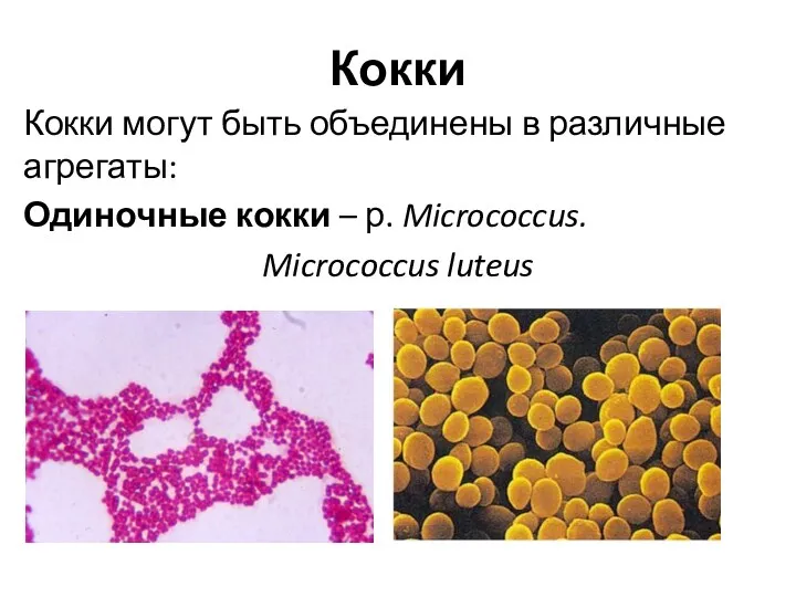 Кокки Кокки могут быть объединены в различные агрегаты: Одиночные кокки – р. Micrococcus. Micrococcus luteus