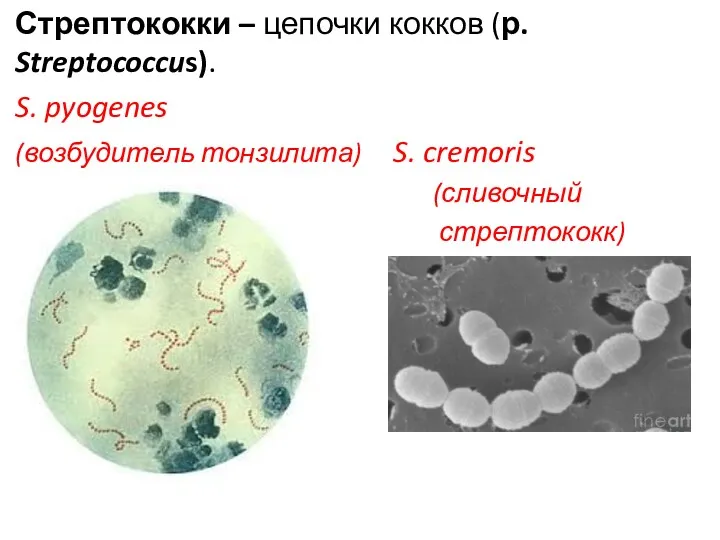 Стрептококки – цепочки кокков (р. Streptococcus). S. pyogenes (возбудитель тонзилита) S. cremoris (сливочный стрептококк)