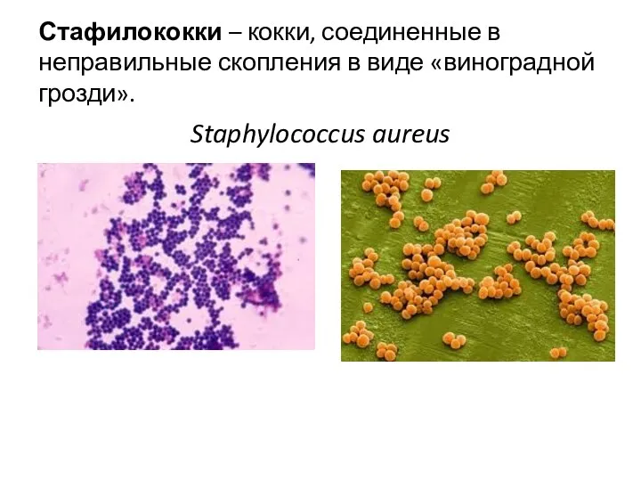 Стафилококки – кокки, соединенные в неправильные скопления в виде «виноградной грозди». Staphylococcus aureus
