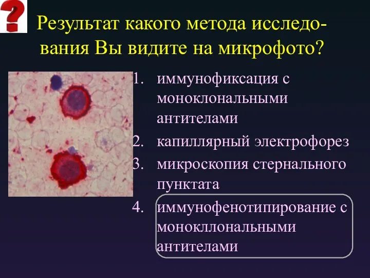 Результат какого метода исследо-вания Вы видите на микрофото? иммунофиксация с моноклональными антителами капиллярный