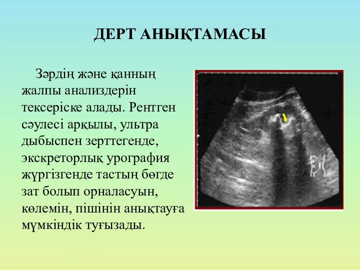 ДЕРТ АНЫҚТАМАСЫ Зәрдің және қанның жалпы анализдерін тексеріске алады. Рентген