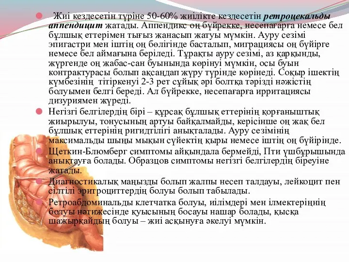 Жиі кездесетін түріне 50-60% жиілікте кездесетін ретроцекальды аппендицит жатады. Аппендикс