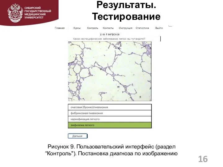 Результаты. Тестирование 16 Рисунок 9. Пользовательский интерфейс (раздел “Контроль"). Постановка диагноза по изображению