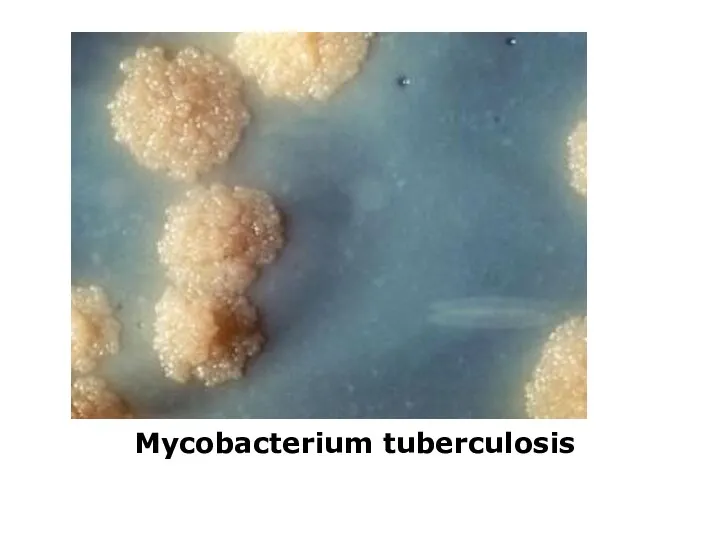 Mycobacterium tuberculosis