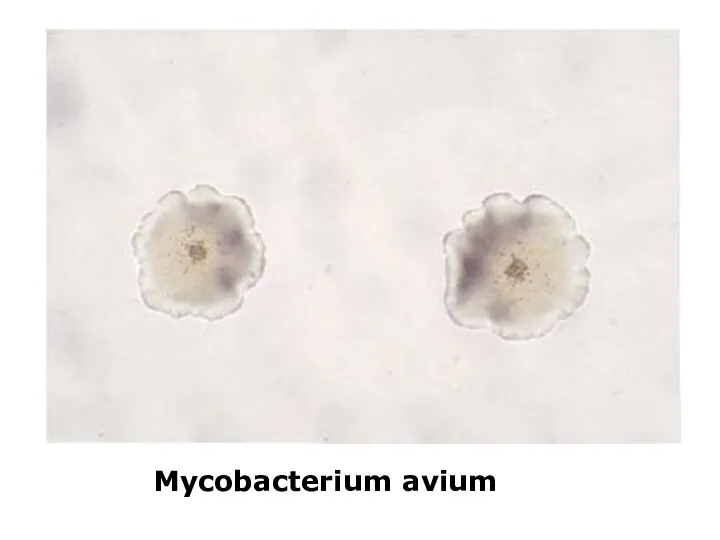 Mycobacterium avium