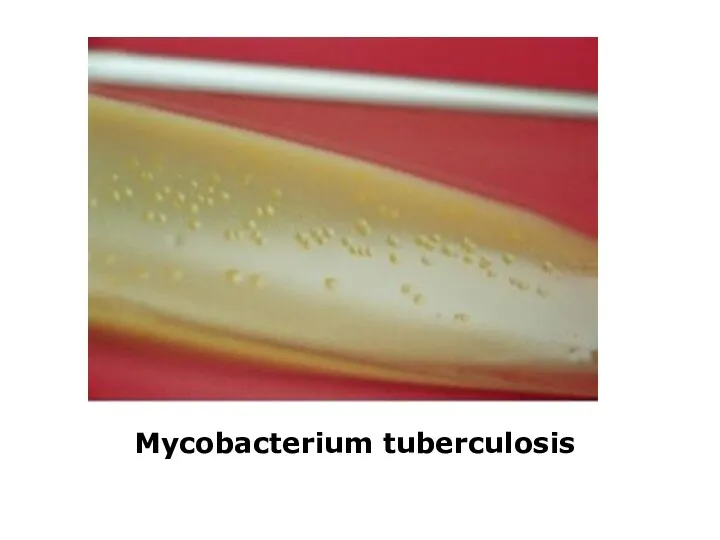 Mycobacterium tuberculosis