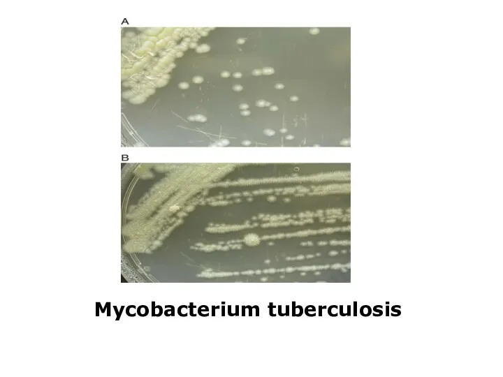 Mycobacterium tuberculosis