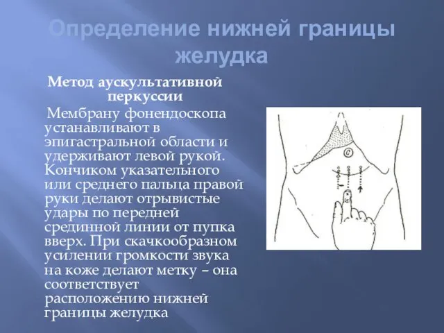 Определение нижней границы желудка Метод аускультативной перкуссии Мембрану фонендоскопа устанавливают