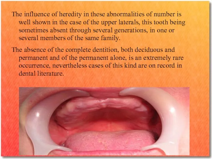 The influence of heredity in these abnormalities of number is