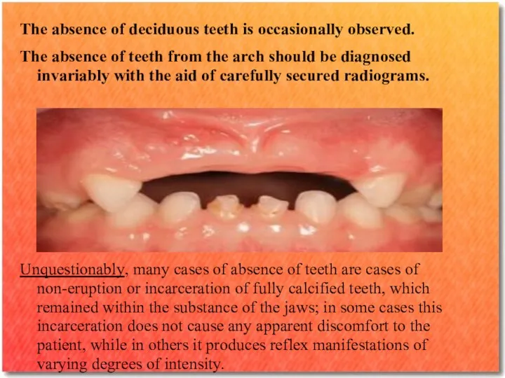 The absence of deciduous teeth is occasionally observed. The absence of teeth from
