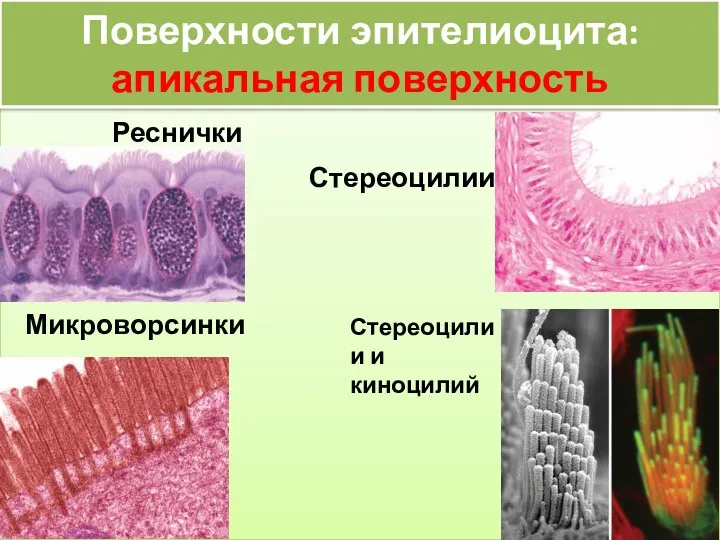 Поверхности эпителиоцита: апикальная поверхность Реснички Стереоцилии Микроворсинки Стереоцилии и киноцилий