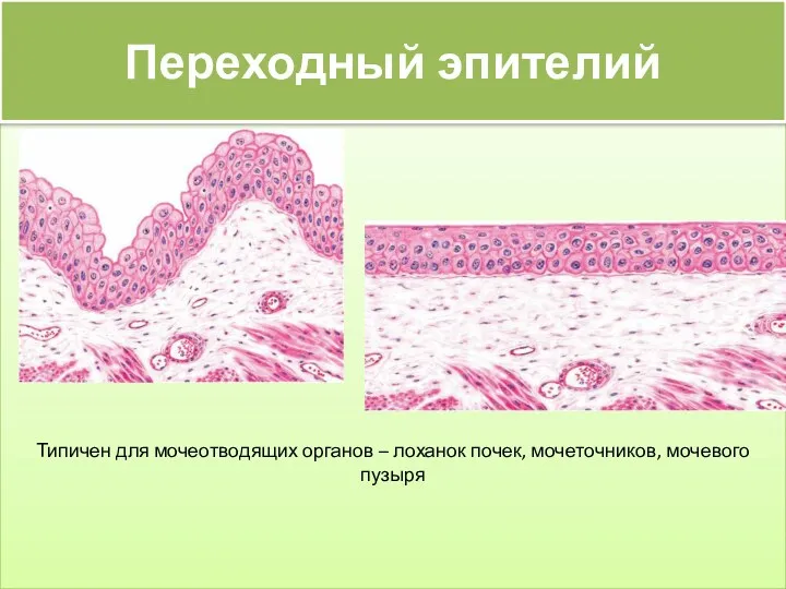 Типичен для мочеотводящих органов – лоханок почек, мочеточников, мочевого пузыря Переходный эпителий