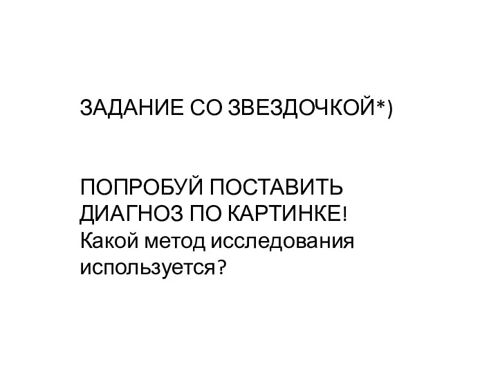 ЗАДАНИЕ СО ЗВЕЗДОЧКОЙ*) ПОПРОБУЙ ПОСТАВИТЬ ДИАГНОЗ ПО КАРТИНКЕ! Какой метод исследования используется?