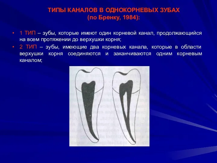 ТИПЫ КАНАЛОВ В ОДНОКОРНЕВЫХ ЗУБАХ (по Бренку, 1984): 1 ТИП