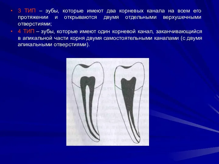 3 ТИП – зубы, которые имеют два корневых канала на