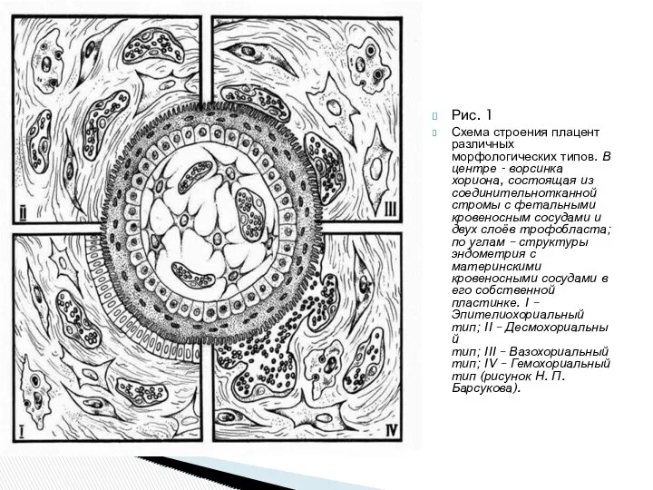 Рис. 1 Схема строения плацент различных морфологических типов. В центре