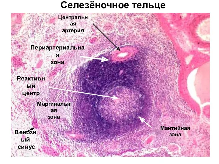 Селезёночное тельце Центральная артерия Реактивный центр Маргинальная зона Мантийная зона Периартериальная зона Венозный синус