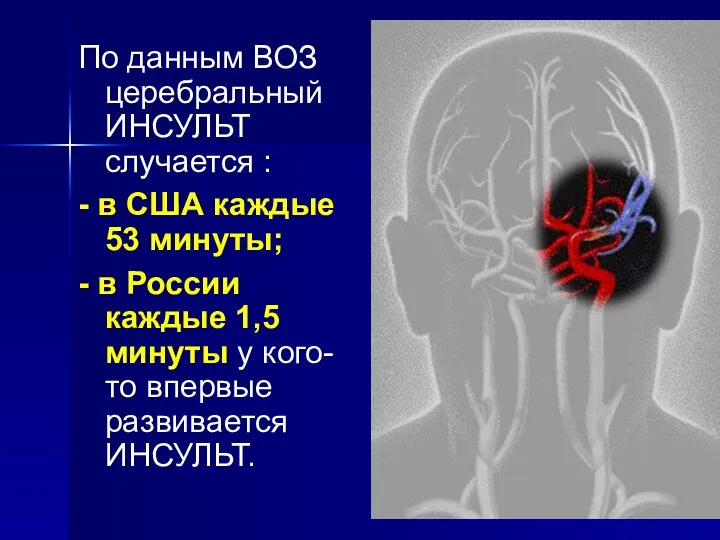 По данным ВОЗ церебральный ИНСУЛЬТ случается : - в США