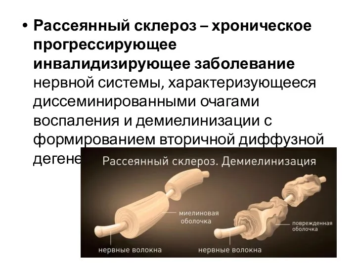 Рассеянный склероз – хроническое прогрессирующее инвалидизирующее заболевание нервной системы, характеризующееся