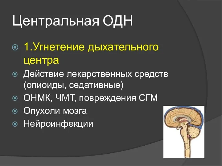 Центральная ОДН 1.Угнетение дыхательного центра Действие лекарственных средств (опиоиды, седативные)