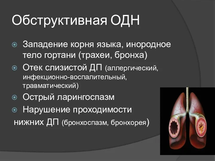 Обструктивная ОДН Западение корня языка, инородное тело гортани (трахеи, бронха) Отек слизистой ДП